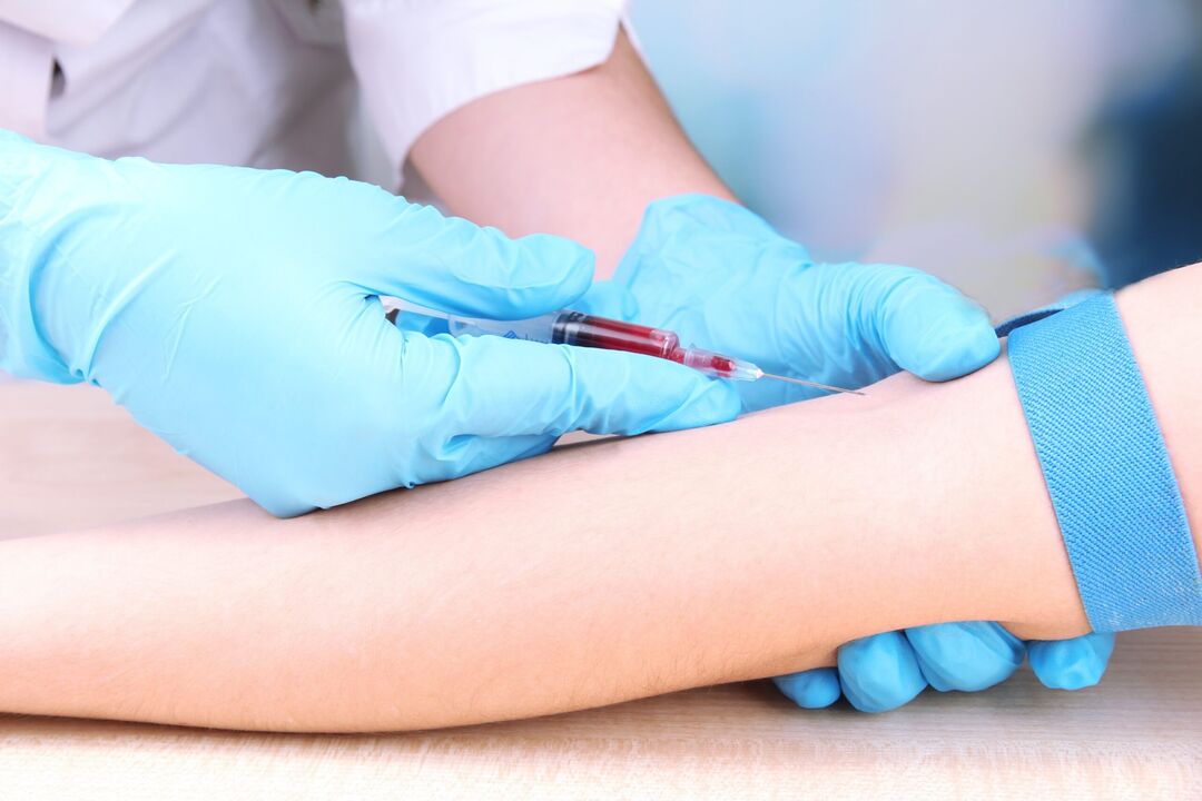 blood draw from a vein to detect worms