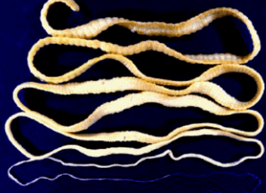 Tsepni