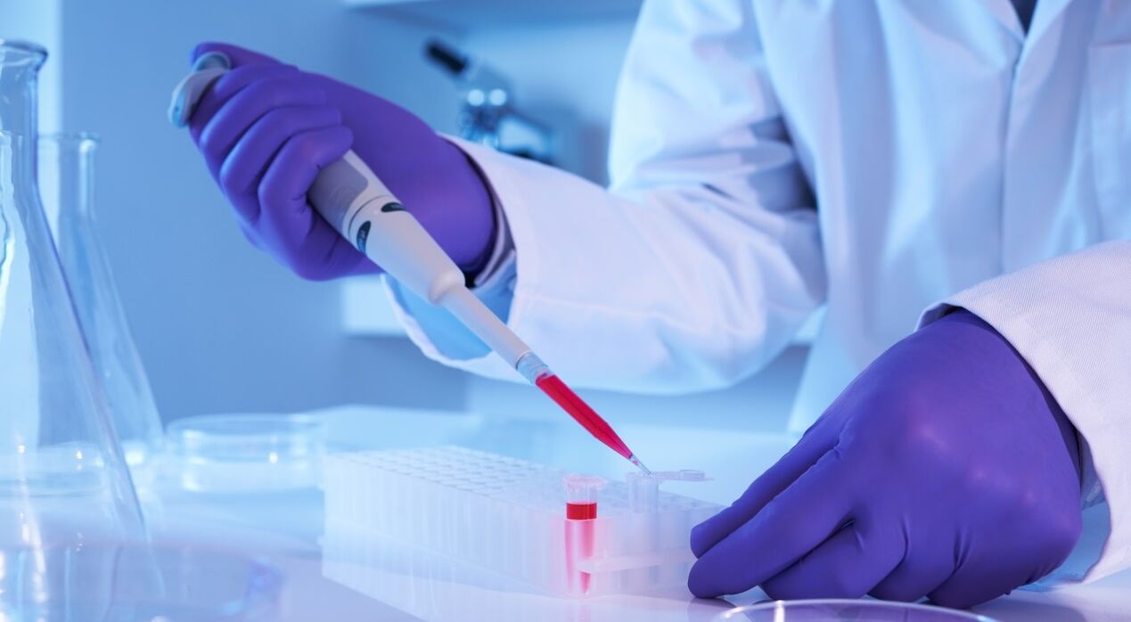 How to perform a parasite analysis