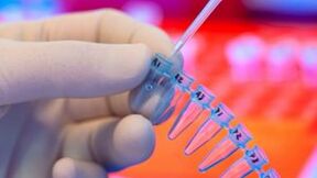How to do the parasites tests