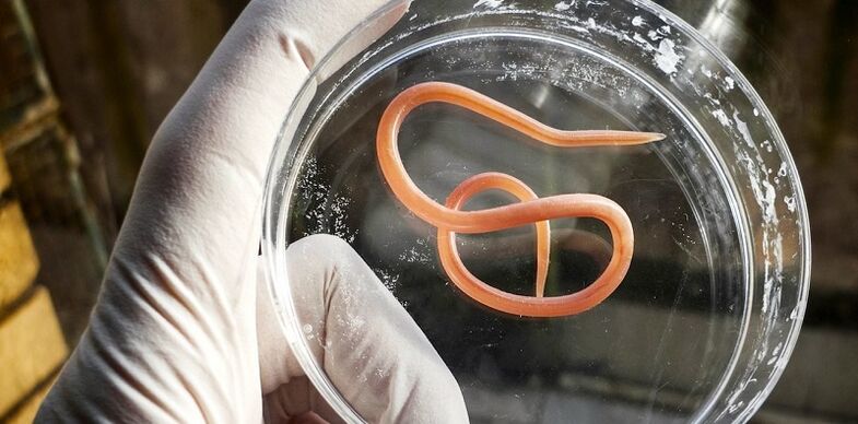 parasite from the human body