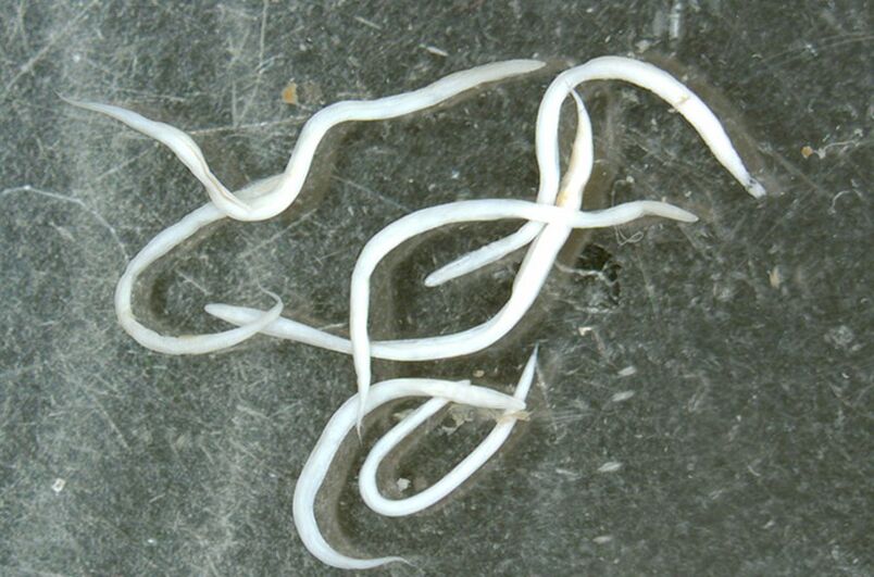 a worm parasite from the human body