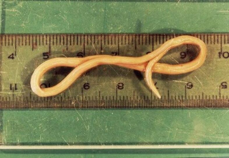 roundworm parasite from the human body