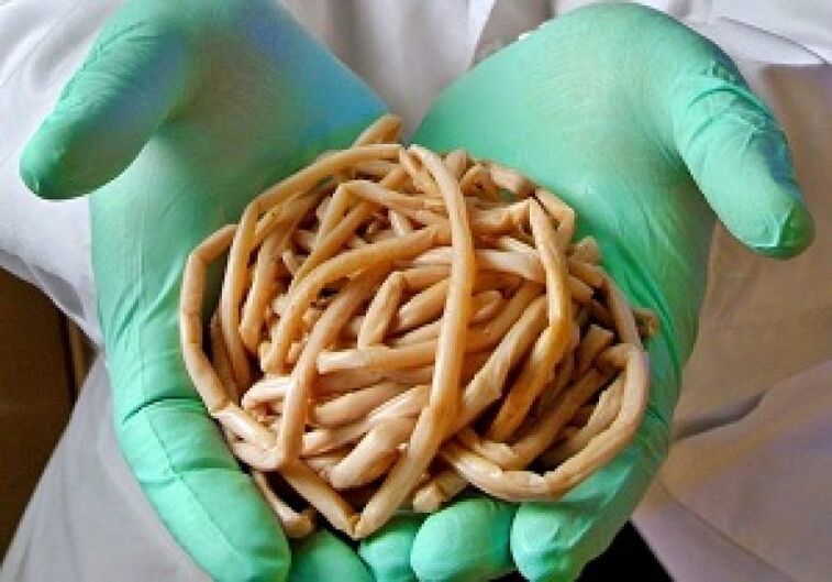 Parasitic worms from the human body