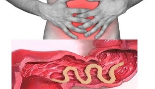 presence of parasites in human intestines